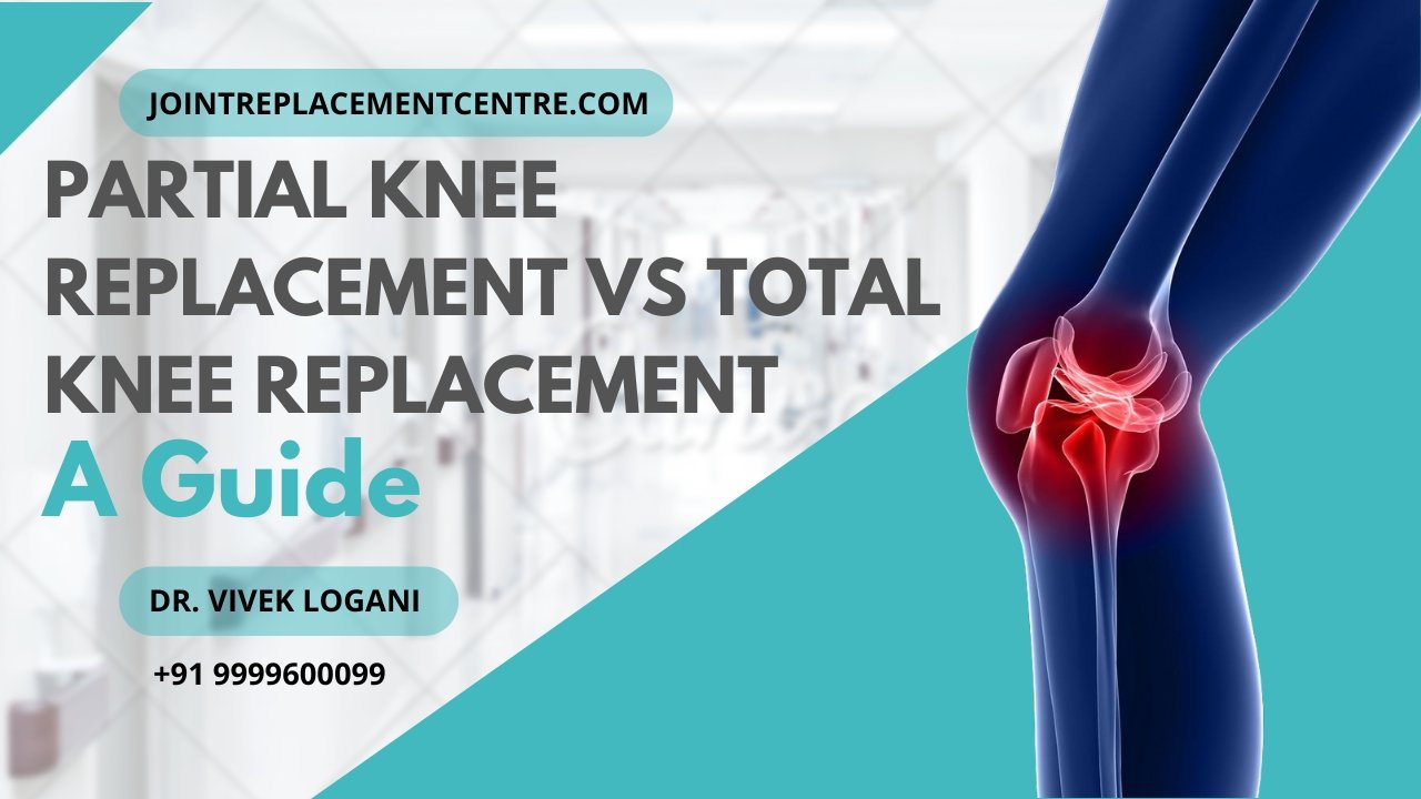 Orthopedic Doctor in Gurgaon